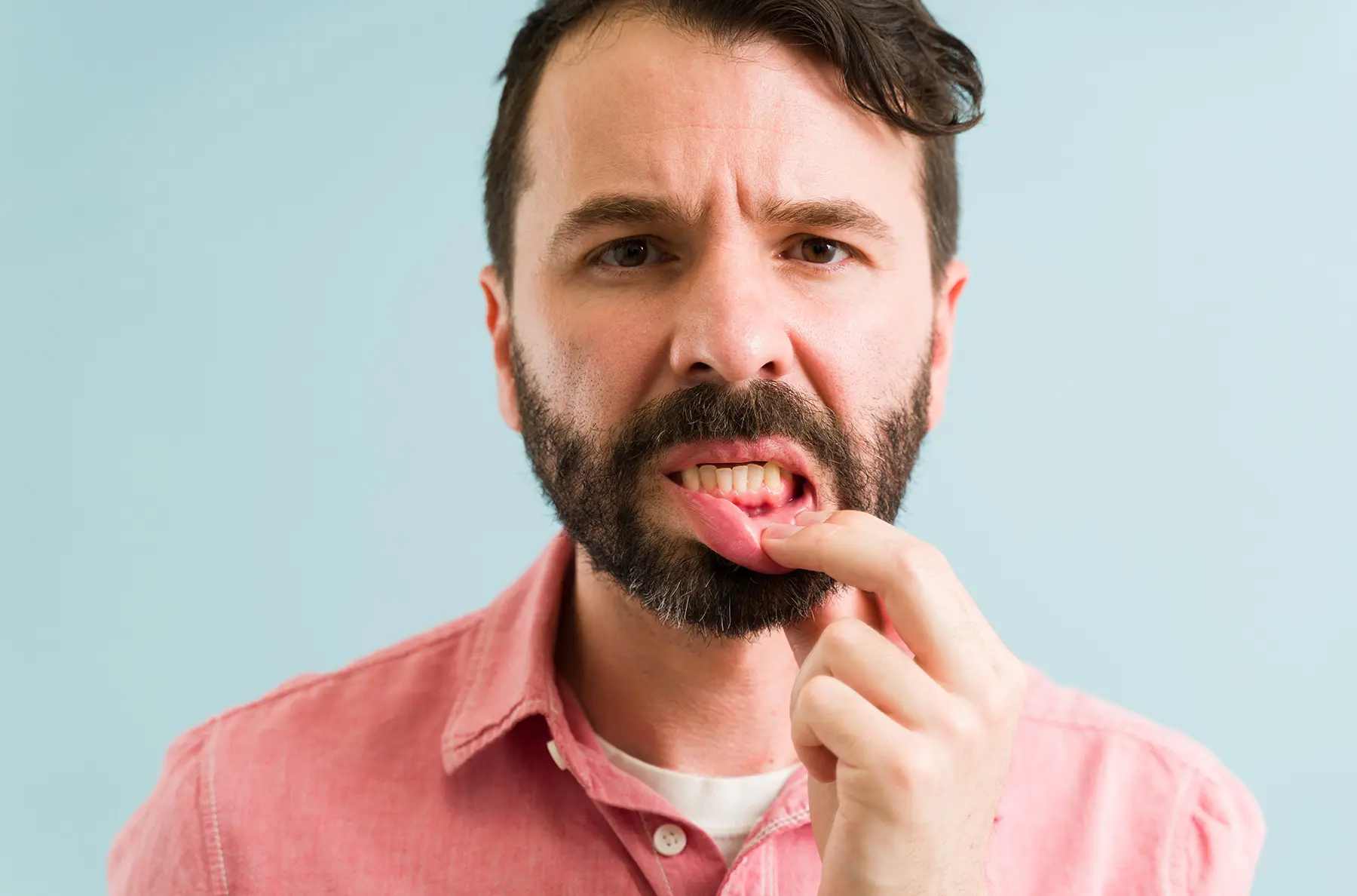 Gum Disease Stages: How Periodontal Disease Progresses Over Time